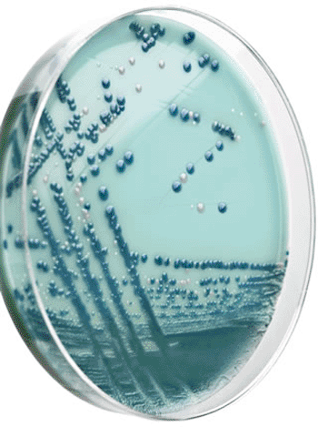 Image: Carbapenem-Resistant Enterobacteriaceae (CRE) (Photo courtesy of Oxoid).